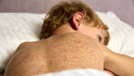 Основные причины отказа павлодарских родителей от вакцинации детей назвали санврачи